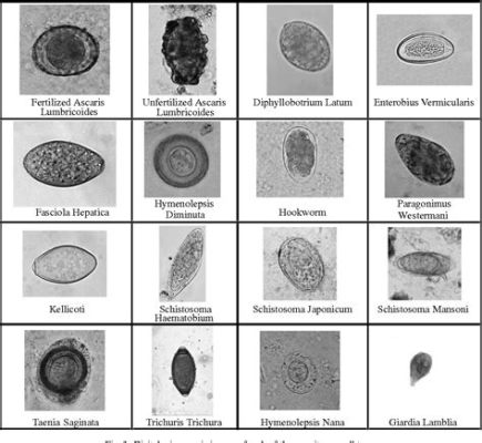  Breviata! Un Amoebozoos Microscópico con un Apetito Insaciable