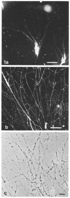  Reticulomyxa: ¡Un Maestro del Disfraz que Te Hará Replantear la Vida!